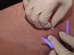 Shining needles torture the female slave
